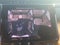 2024 Jeep Grand Cherokee L Summit Reserve